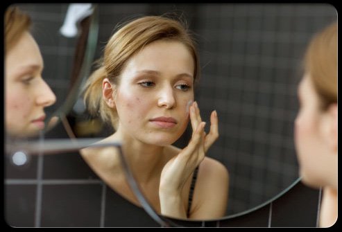 Cum să prevenim apariția acneei și care sunt cele mai comune cauze care duc la apariția acesteia