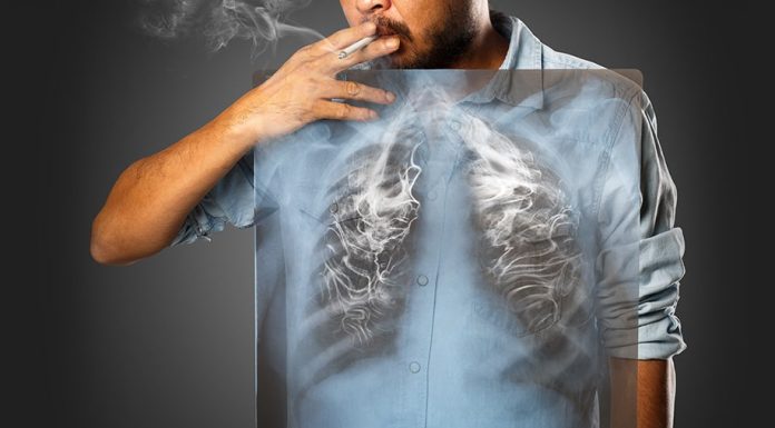 De la tigara la cancer: 8 lucruri pe care un fumator ar trebui sa le stie